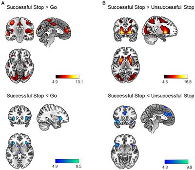 Lifespan adversities affect neural correlates of behavioral inhibition in adults